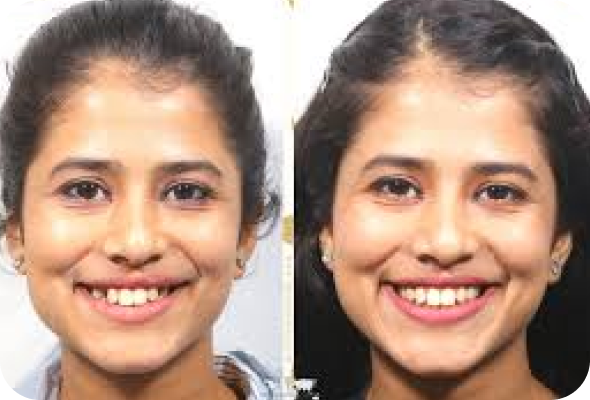 Kavita Sharma Before